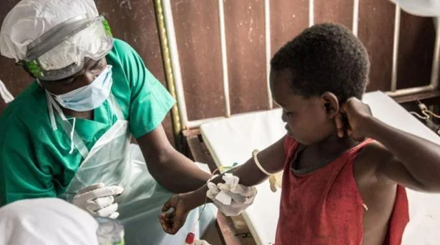 WHO Urges Rapid Increase in Mpox (Monkeypox) Vaccine Production Amid Surge of Dangerous Virus Strain